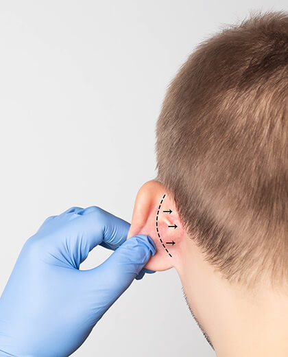 Chirurgie oreilles